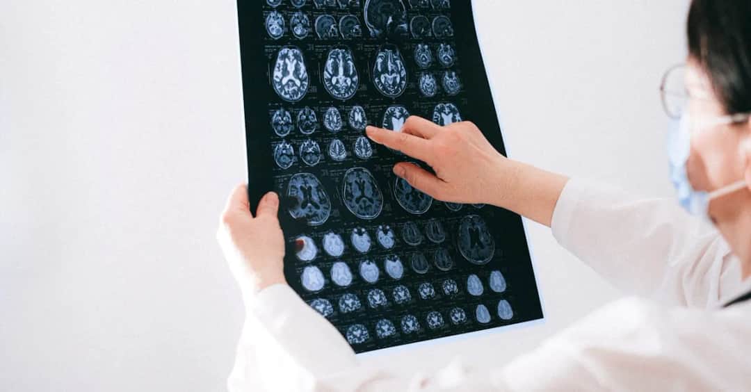 Czy Ginkofar naprawdę poprawia pamięć? To zaskakujące opinie