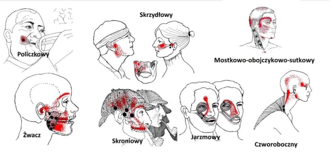 Ból szczęki na tle nerwowym? To przyczyny i sposoby ulgi. Poradnik